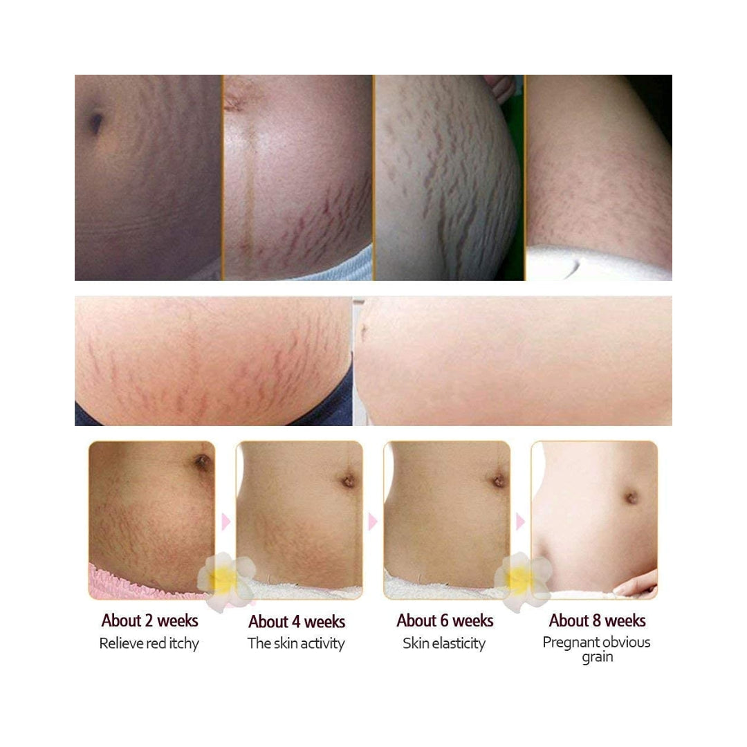 Crema Para Estrias y Cicatrices 40 Gr RtopR Biokusy