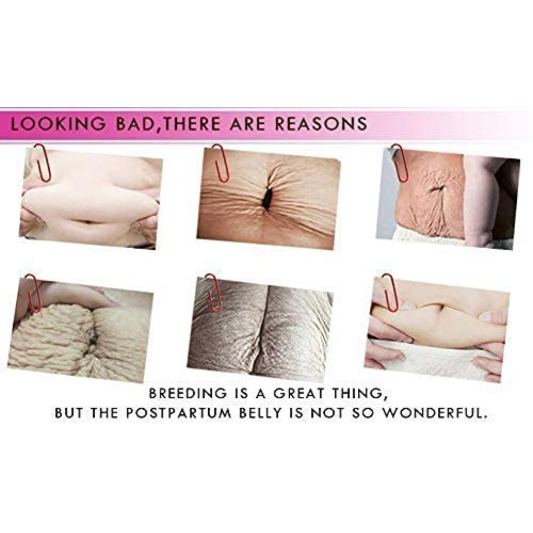 Crema Para Estrias y Cicatrices 40 Gr RtopR Biokusy