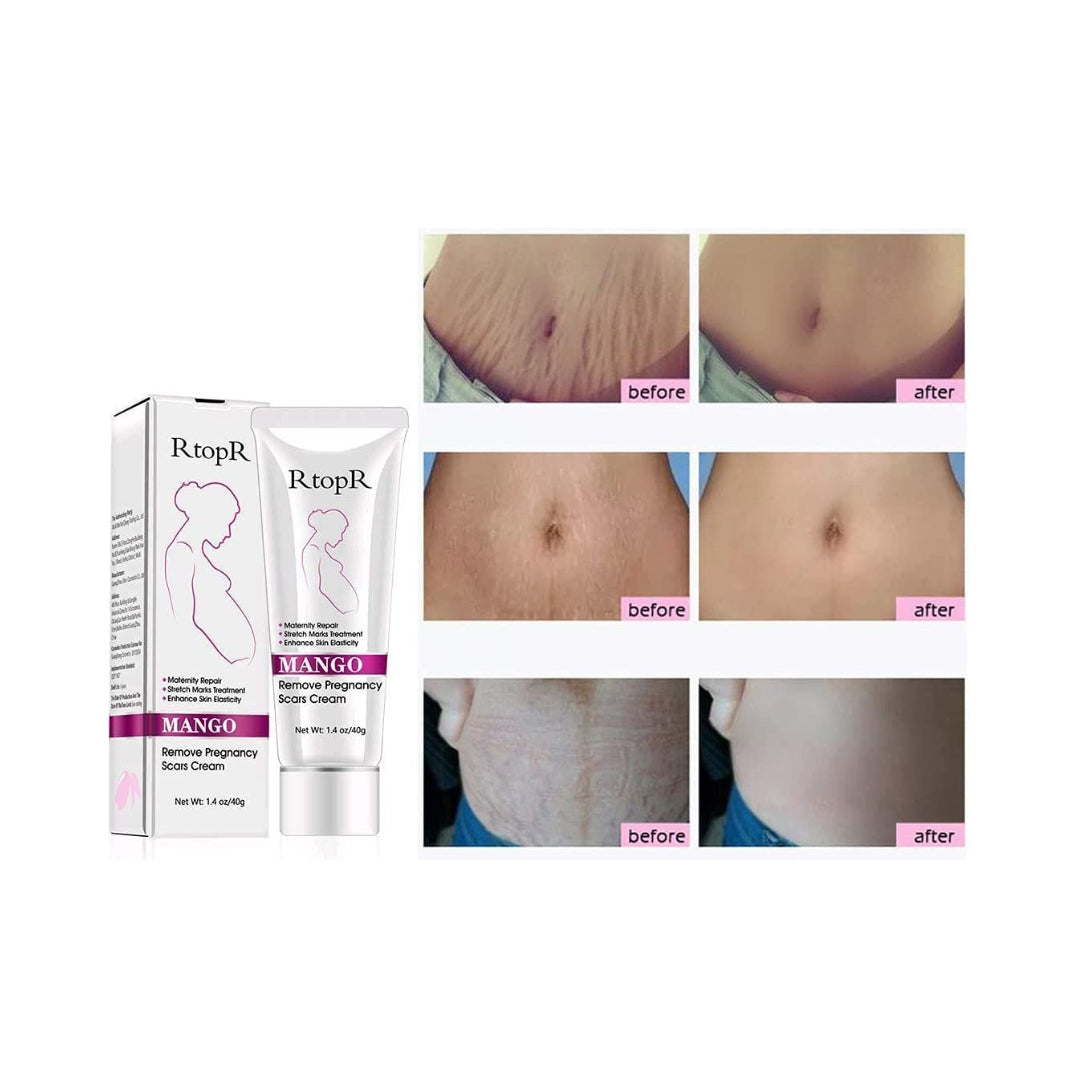 Crema Para Estrias y Cicatrices 40 Gr RtopR Biokusy